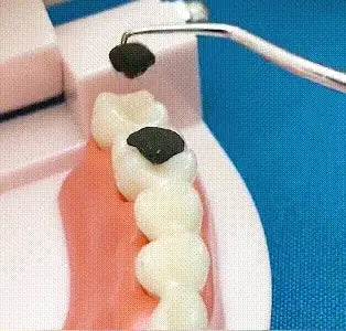 【🔥Kúp 2 a získaj 2 zadarmo🔥】Sada špáradiel z nerezovej ocele