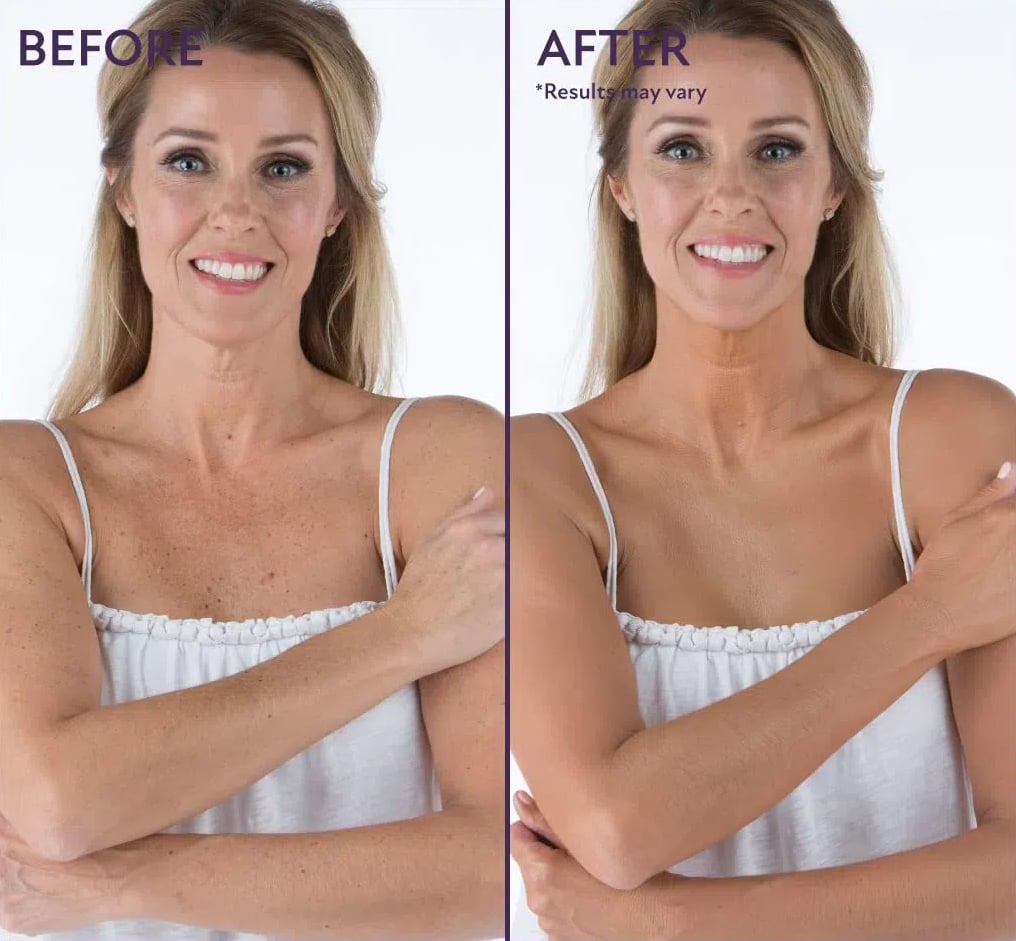 【🔥 Kúpte 1, získajte 1 zadarmo🔥】Zdokonaľovač celej pleti