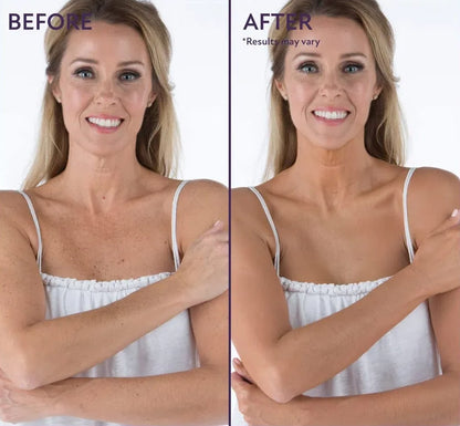 【🔥 Kúpte 1, získajte 1 zadarmo🔥】Zdokonaľovač celej pleti