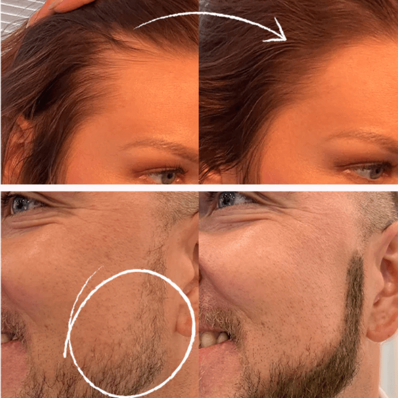 Výplň hustoty vlasov