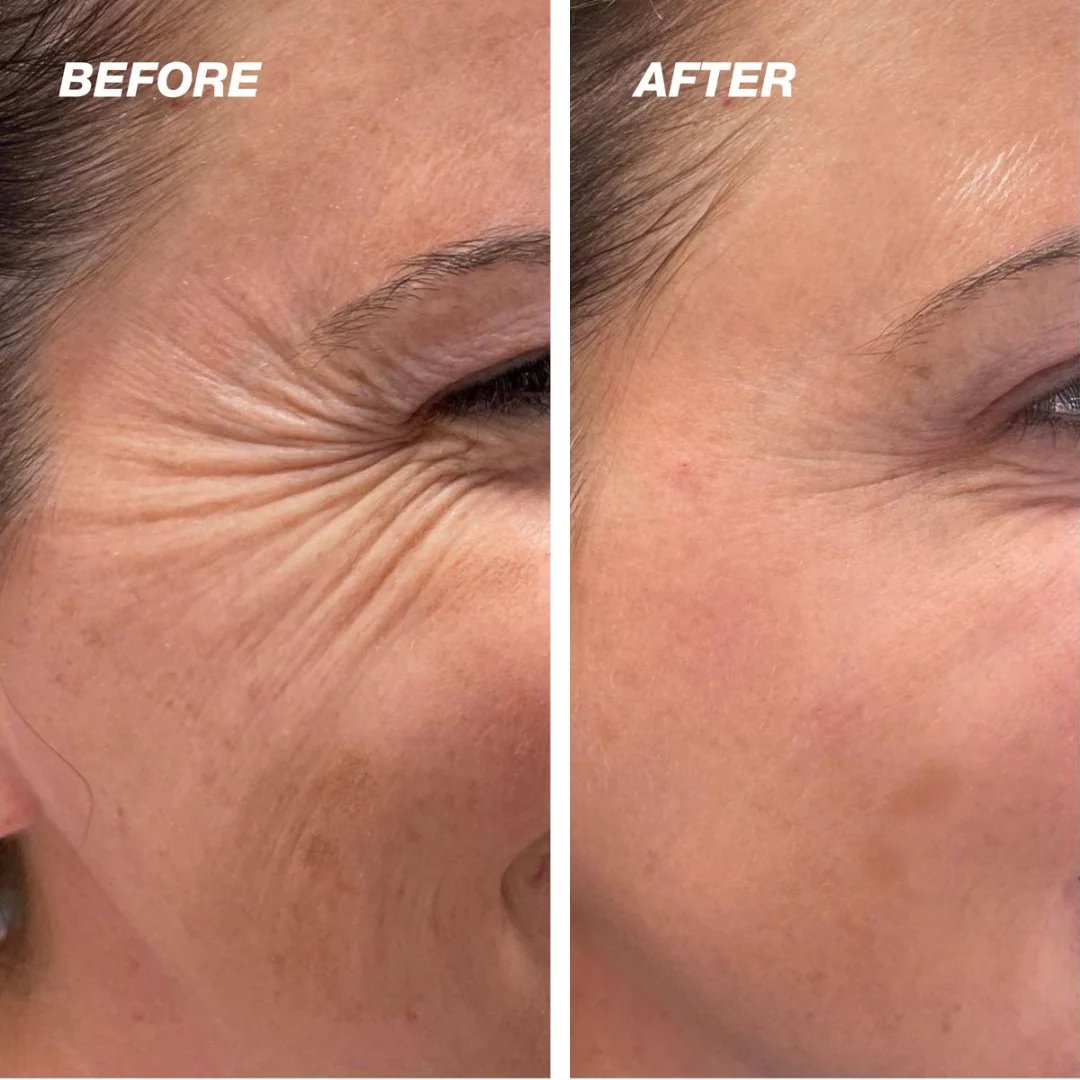 HOOMWELL™ Vita A Retinal Shot spevňujúci posilňovač