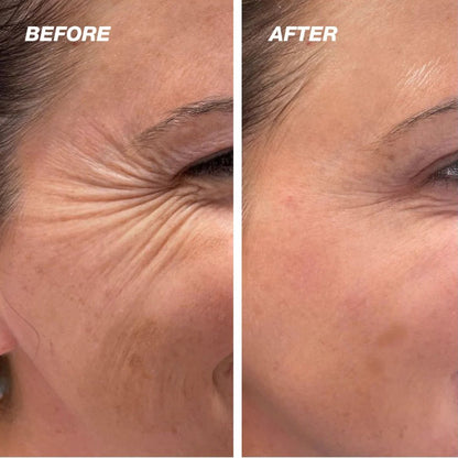 HOOMWELL™ Vita A Retinal Shot spevňujúci posilňovač