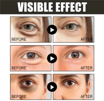 (🔥Kúp 1 a získaj 1 zadarmo🔥)Krema za oči s kofeinom