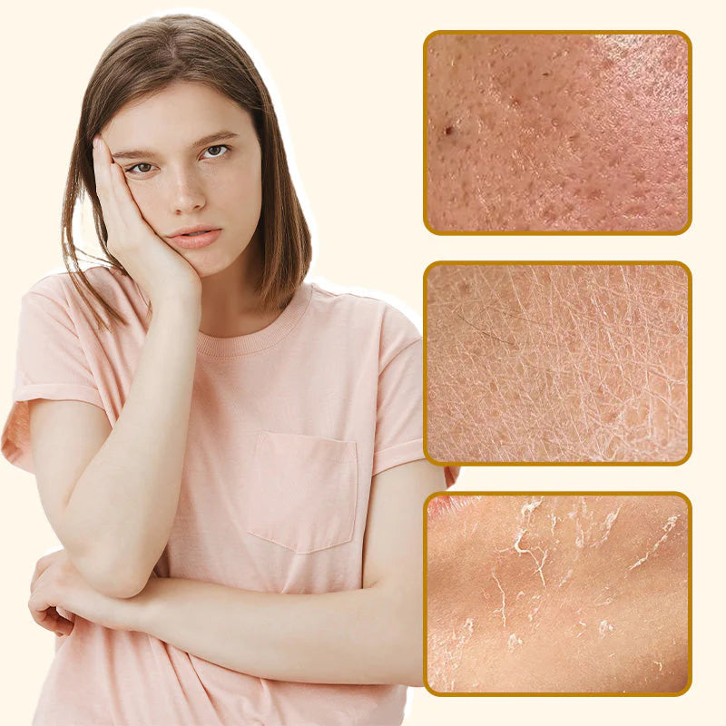 【🛍️ Druhý -50%】Organický hovädzí loj a medový balzam s hydratačnými vlastnosťami