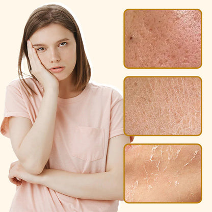 【🛍️ Druhý -50%】Organický hovädzí loj a medový balzam s hydratačnými vlastnosťami