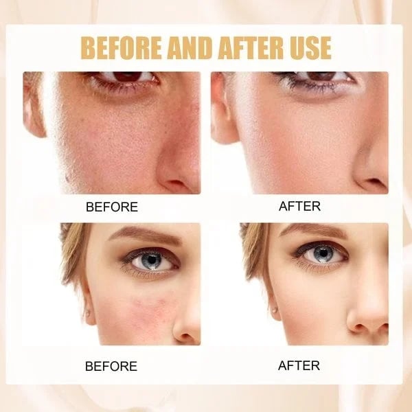 （🔥Kúpte 1 a získajte 1 zadarmo🔥）Podkladová báza pre zrelú pleť so zafarbením pleti