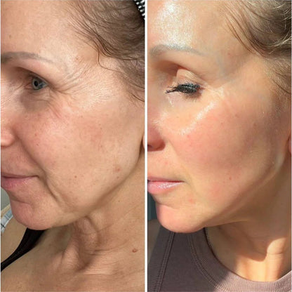 HOOMWELL™ Vita A Retinal Shot spevňujúci posilňovač