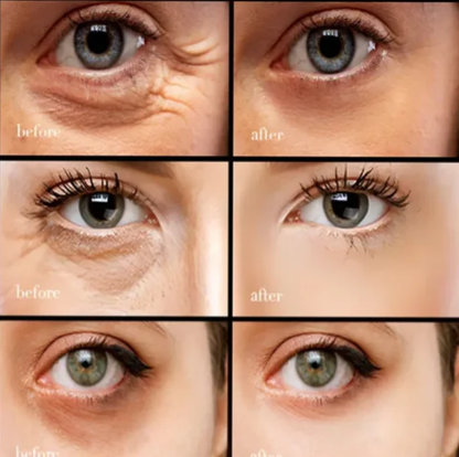 （💕Kúp 1 získaj 1 zadarmo💕）Krema za oči s kofeinom